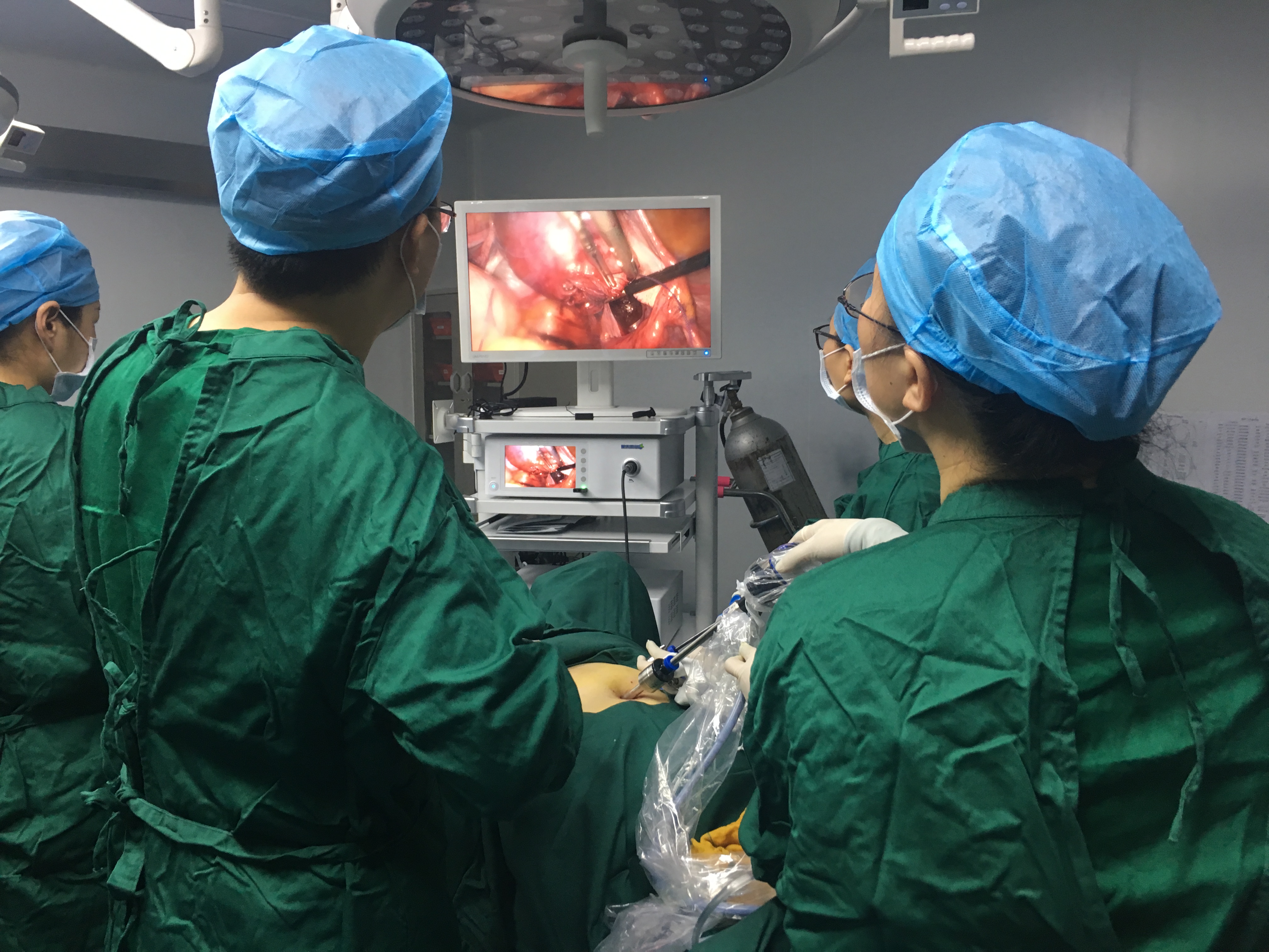 科普健康｜腹腔镜下子宫肌瘤剥除术