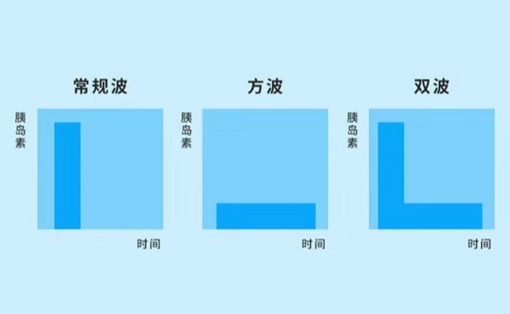 胰岛素泵的基本知识,经验之谈肺腑之言精典