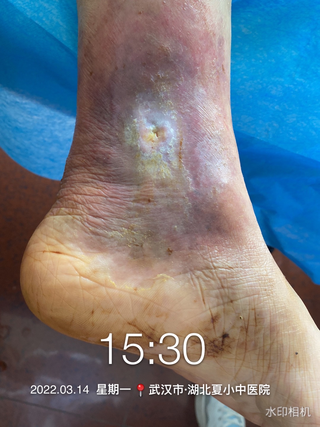 打赢持久战,打赢歼灭战打好持久战