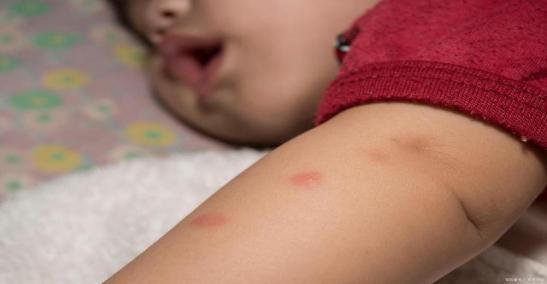 蟑螂怎么消灭最彻底最好的方法,蟑螂怎么正确消灭最彻底最有效