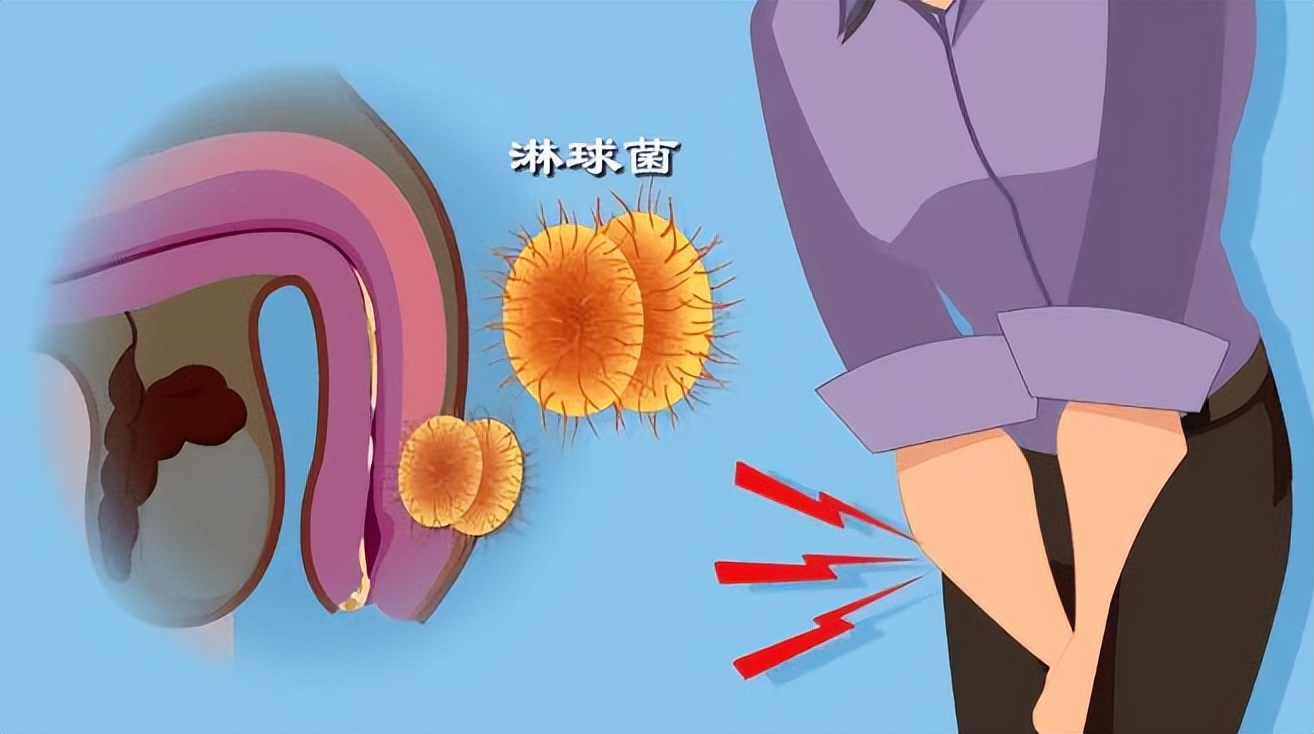 八种疾病传播途径,八种性传播疾病及病原体