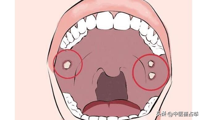 药店买什么中成药最好,十种中成药药店不愿意卖