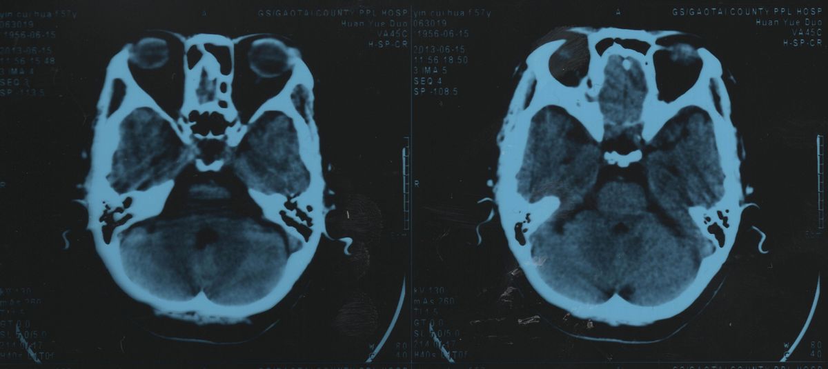 人体不同味道的液体,人体各种液体的区别