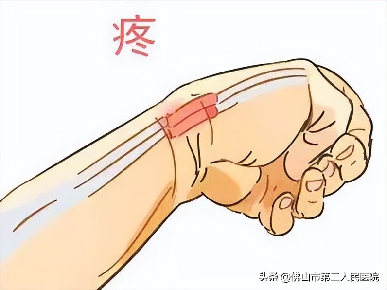 颈肩针灸要多久才能治好,弹响指做针灸能彻底根治吗