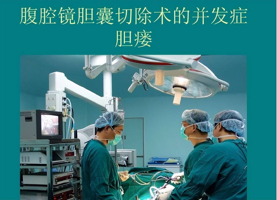 急性胆囊炎的主要治疗方法有哪些,急性胆囊炎最佳的治疗方案是什么