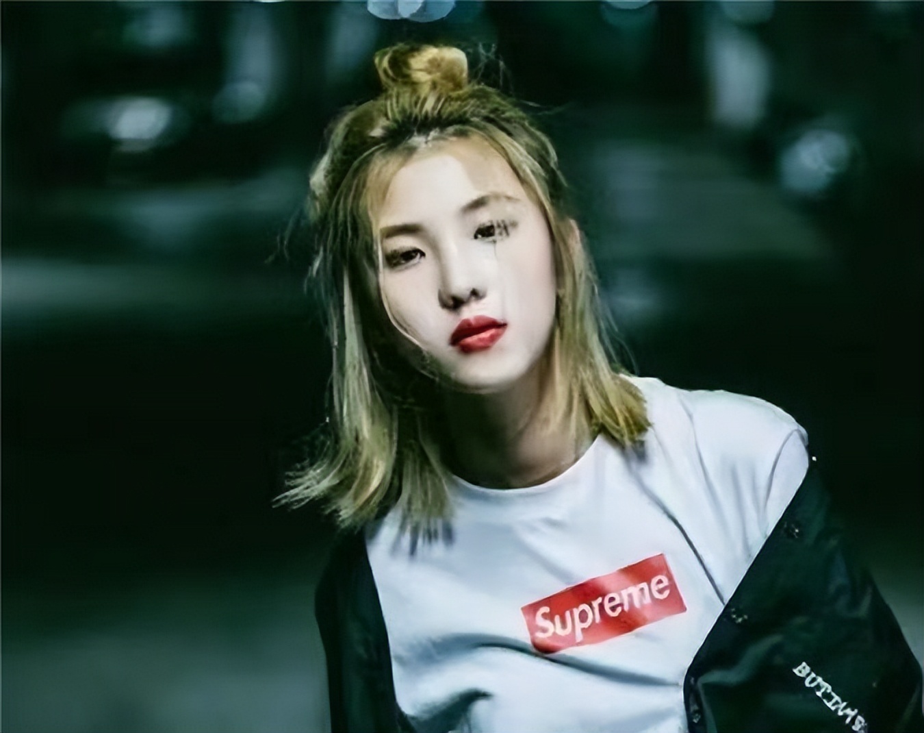 辽宁巨婴刘思琦：16岁吃饭靠人喂，每天花销过万，如今过得怎样了