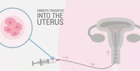 有遗传病可以生孩子吗,老婆有遗传病不能生孩子怎么办