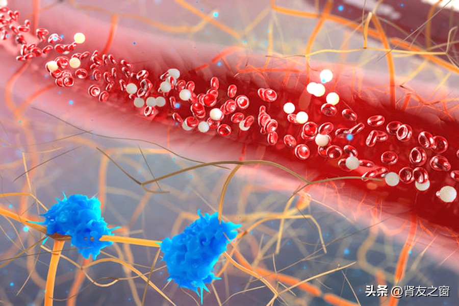 血栓闭塞性脉管炎用什么药,糖尿病足与血栓闭塞性脉管炎鉴别