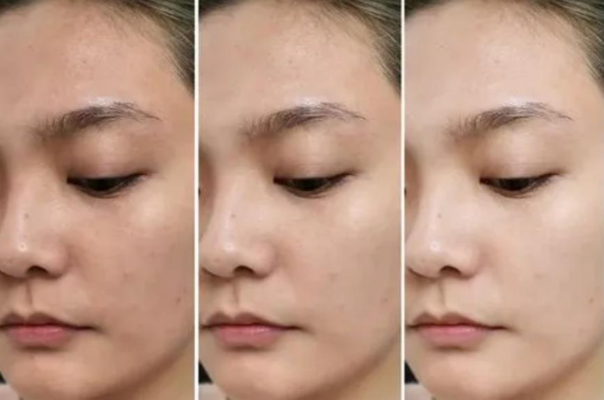 怎么样护肤暗黄皮会变白,黄皮用什么护肤品可以变白