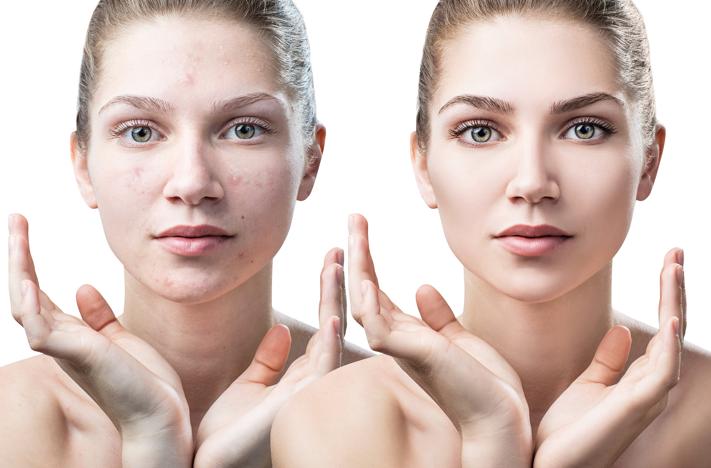 椤荤柈鍚冨紓缁碼閰告湁鐢ㄥ悧,鑴镐笂鑴撶柋鐤彲浠ュ悆寮傜淮a閰稿悧