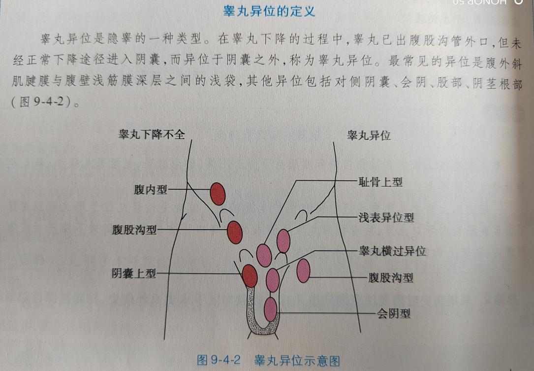男宝阴囊里面没有“小蛋蛋”，后果可能很严重，家长别大意