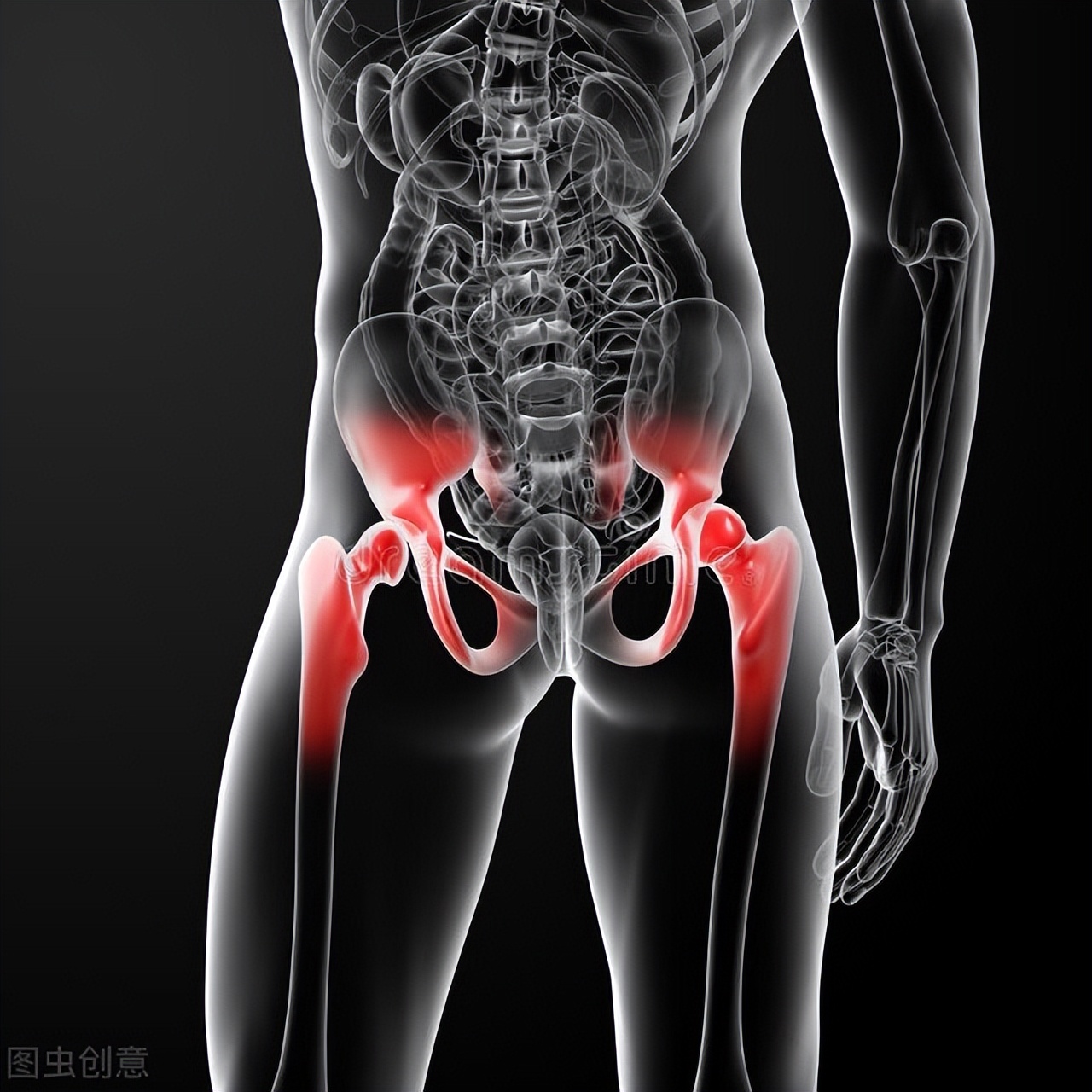 人工髋关节翻修术,人工髋关节翻修能翻修多少次