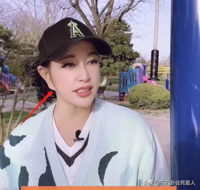 明星整容脸僵硬图片,老女明星整容脸和纯天然脸