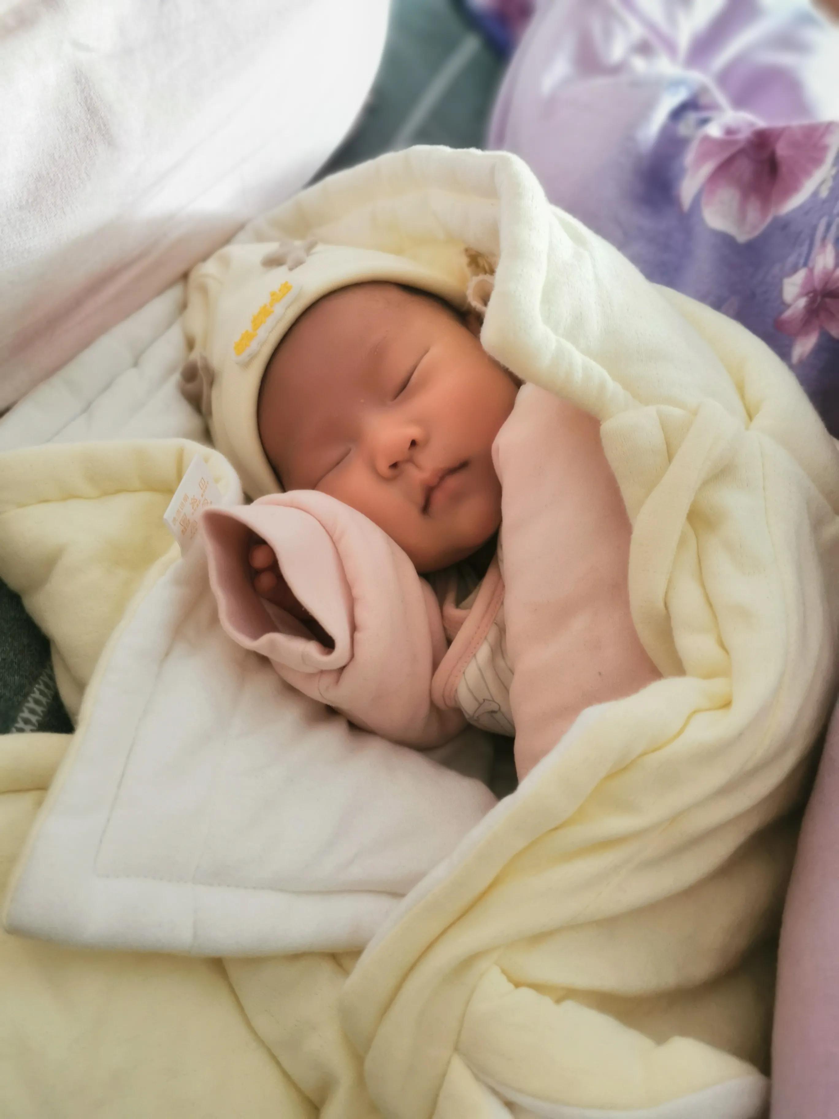 产瘤会使婴儿黄疸增高吗,足月后黄疸增高怎么回事