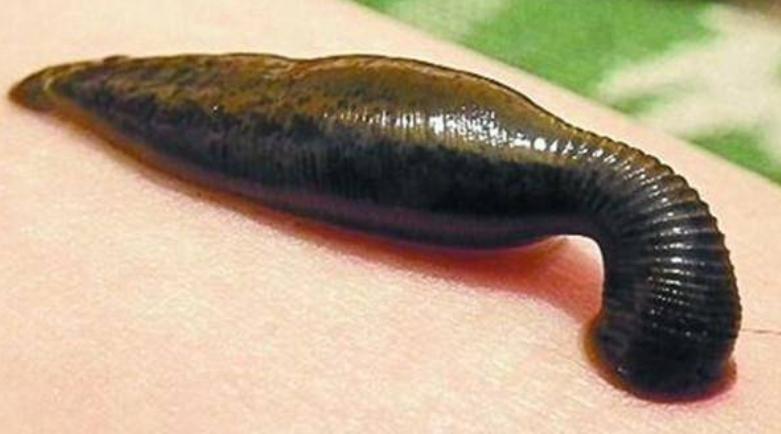 蚂蟥吃到肚子里会存活吗,蚂蟥吃进肚子里还活着吗