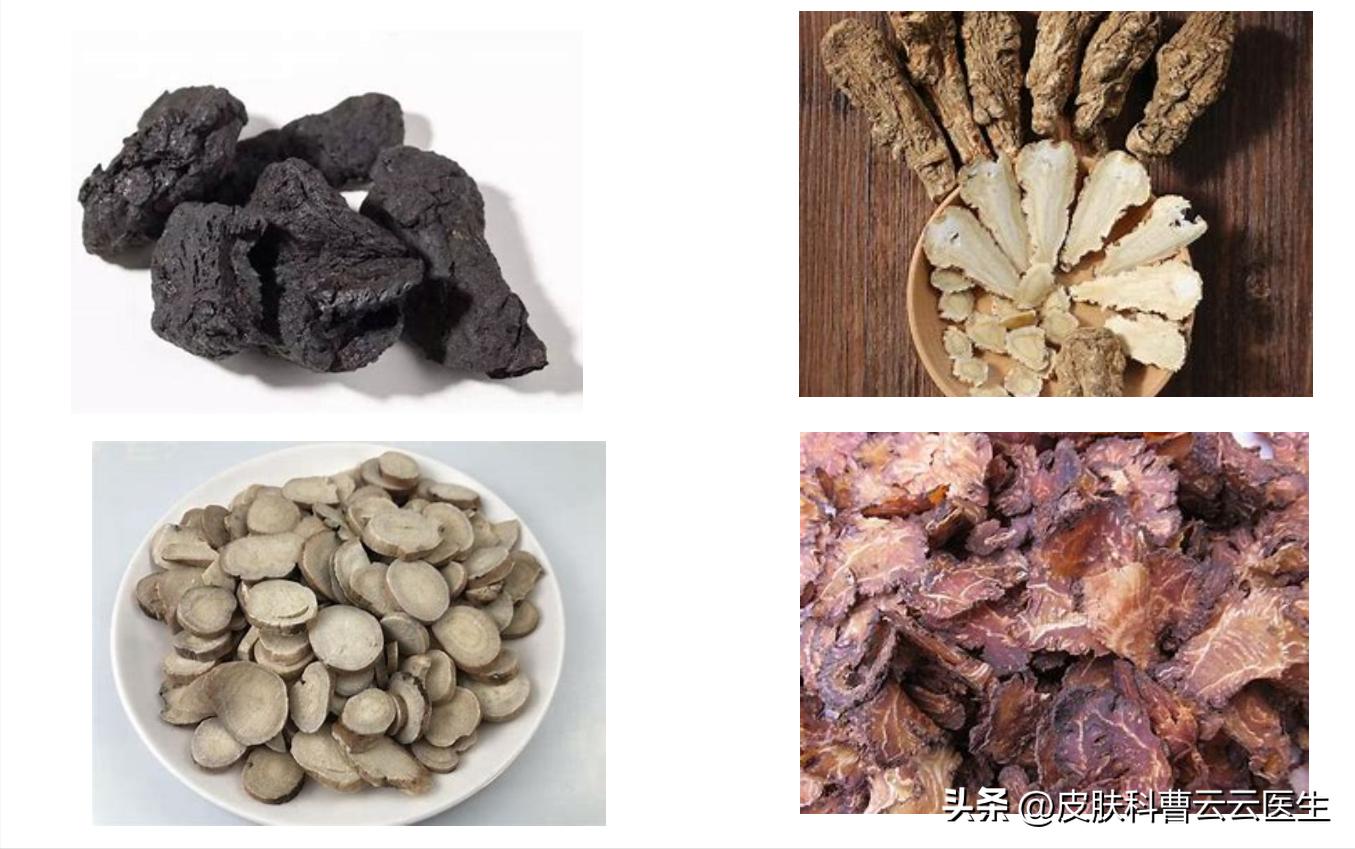 中药治疗银屑病用什么药,张仲景中药治疗银屑病方子