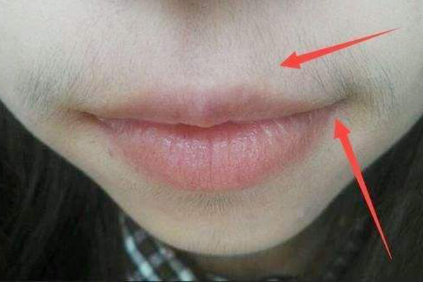 女生不建议刮体毛的原因,女性体毛越来越多是什么原因造成