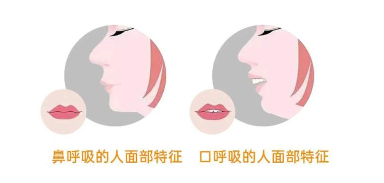 年龄越大凸嘴龅牙会不会越严重,年龄大了龅牙怎么办