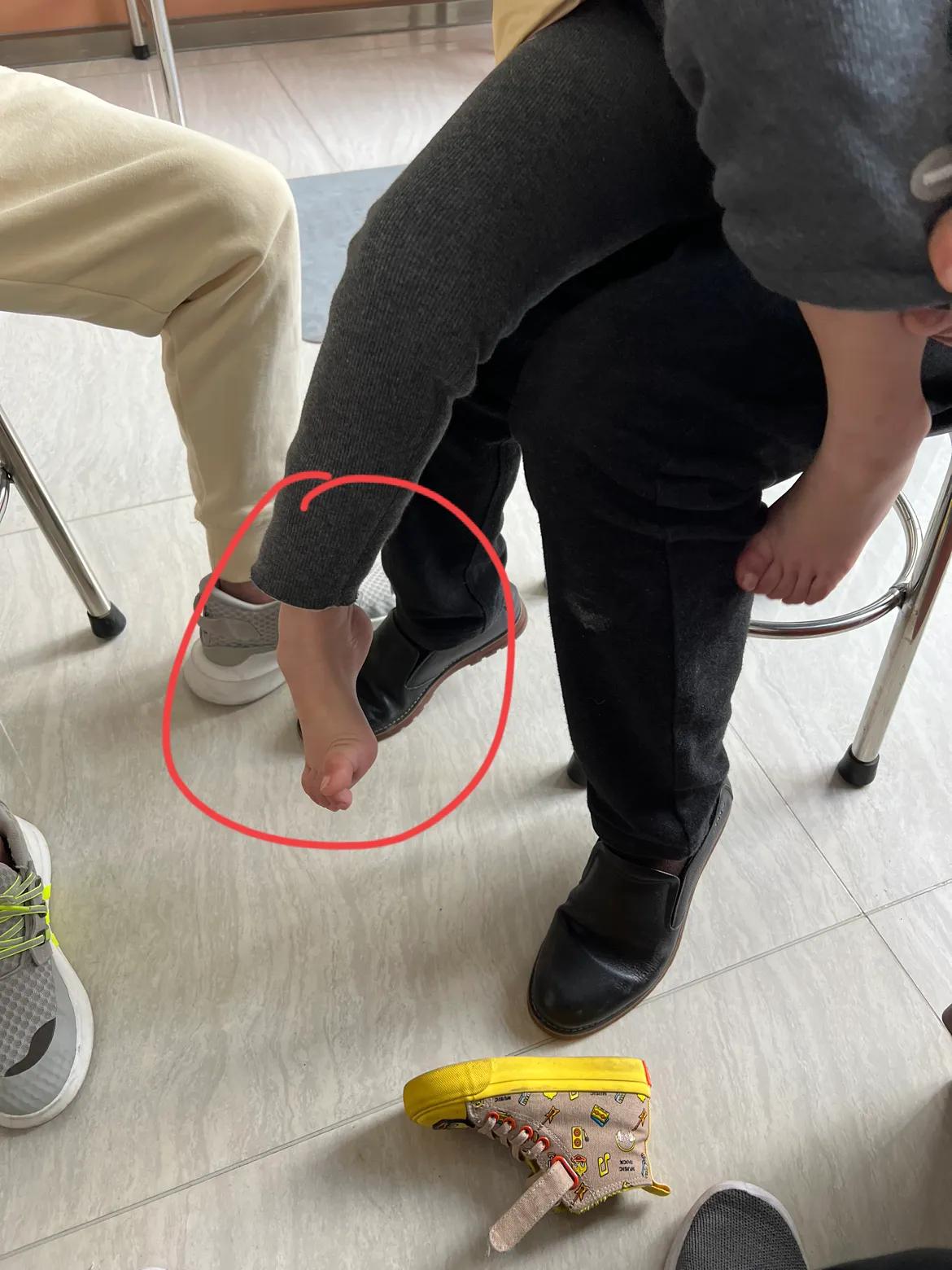 痉挛肌脑瘫家庭干预可以吗,痉挛性脑瘫患儿康复训练家长必看