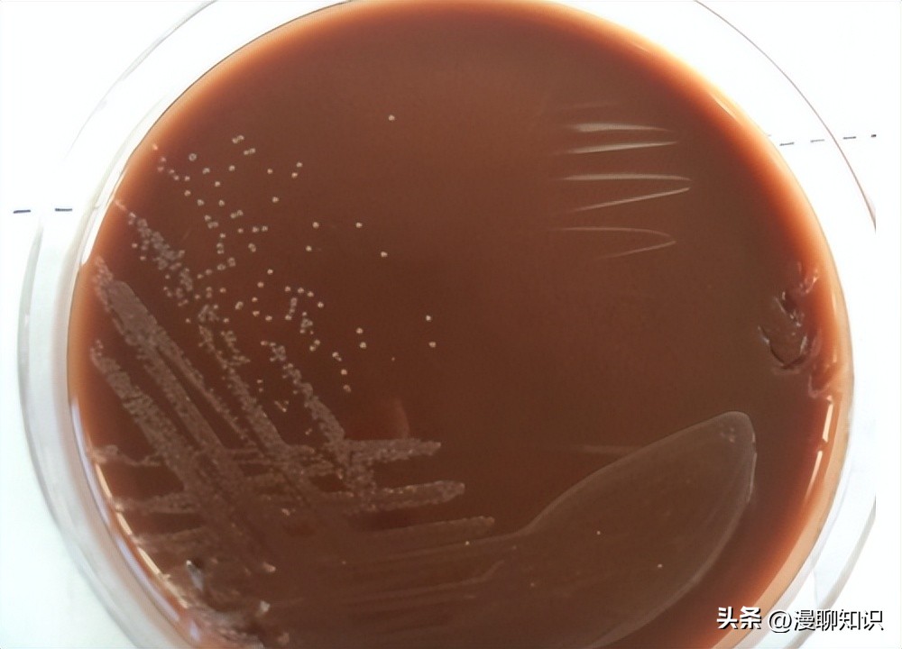 副猪嗜血杆菌是一种巴氏杆菌，其生长依赖于V因子，还有其他的吗