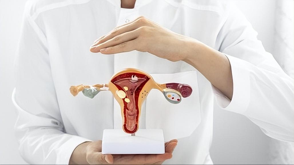 女性得了卵巢癌会有什么症状,女性卵巢癌的症状表现在什么地方