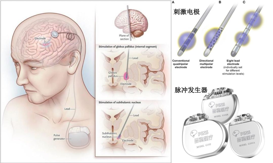 郭爱顺：精湛医技让生命不再颤抖DBS手术受益患者重获新生