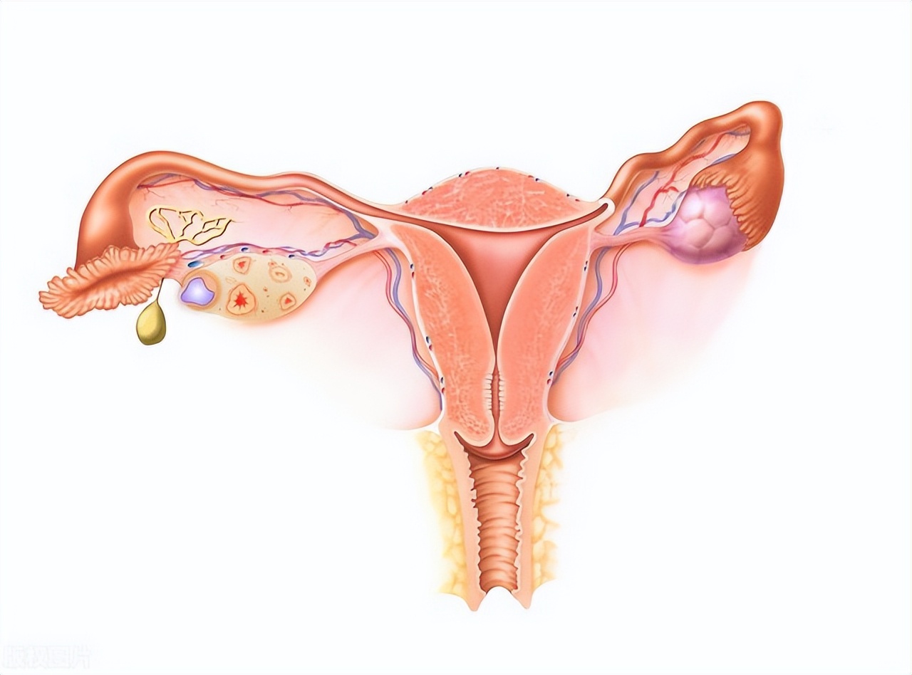 女子巨阴症可以治好吗,巨阴症会影响生育吗