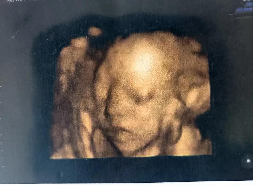 我的试管之路记录,我的试管之路纪录片