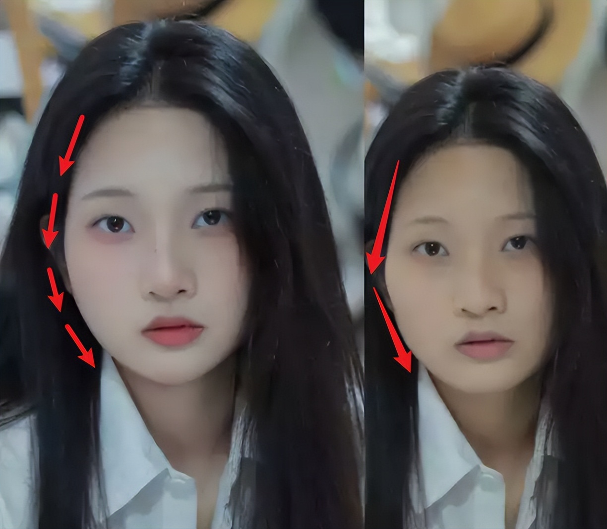 颧骨突出脸型凹陷如何改善,颧骨突出是好看还是不好看