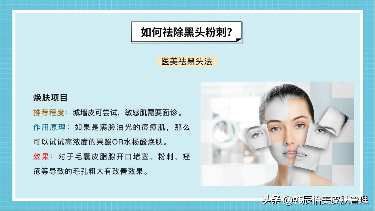 如何用最简单方法去黑头最有效,最有效的去黑头方法小妙招