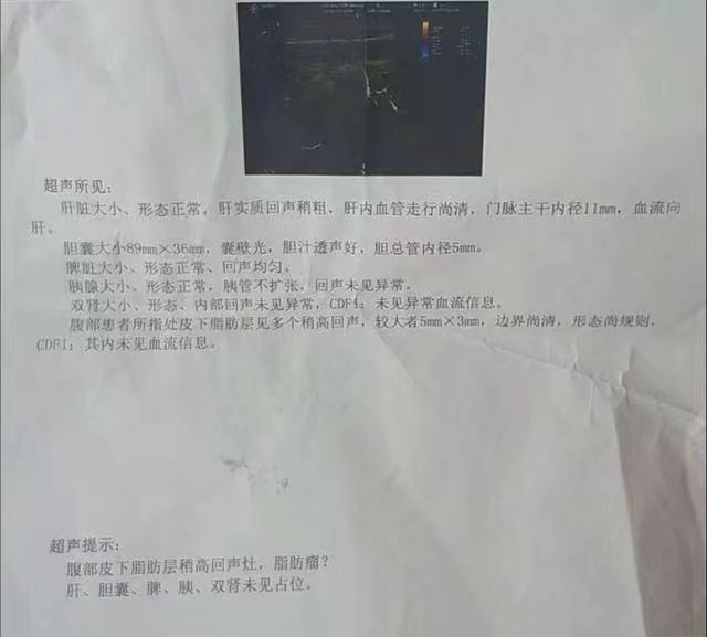 胆囊息肉无需过分恐惧,中医胆囊息肉和胆囊结石中药配方