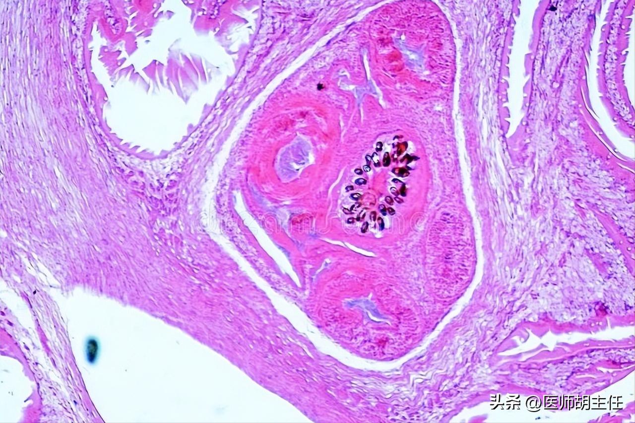 体检肝部囊肿最大2.8怎么办,体检发现肝囊肿肾囊肿