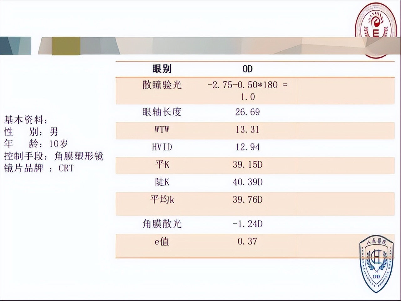 王凯角膜塑形镜原理,王凯医生塑形镜