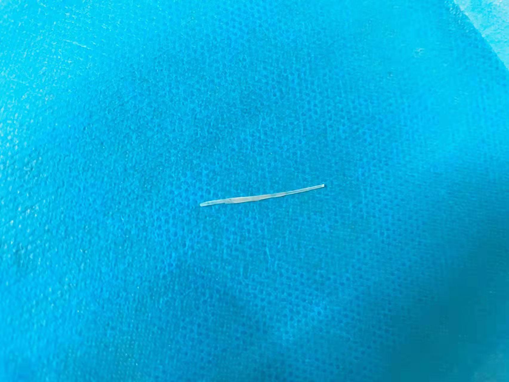 吃鱼了感觉嗓子扎鱼刺但是不疼,春节期间鱼刺卡喉咙怎么办