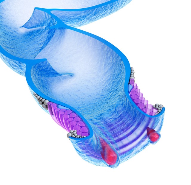 中医肛痈的主要病因在于,肛痈的临床表现及证型