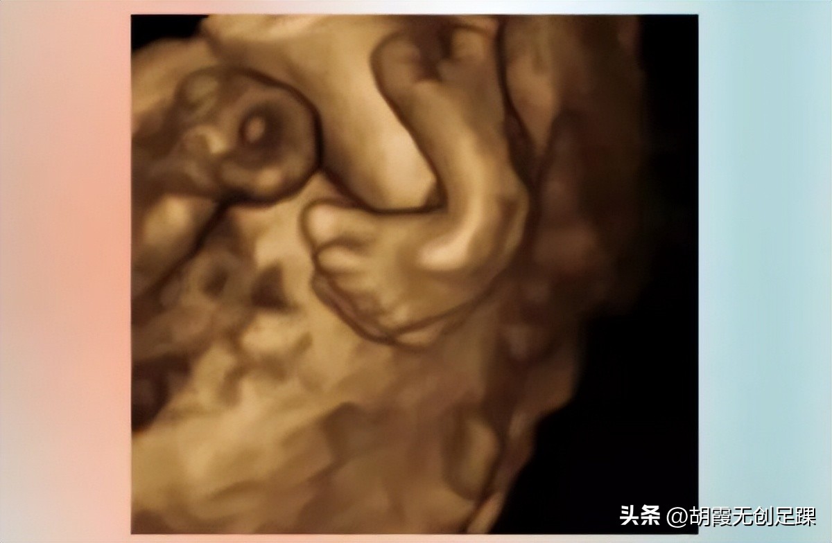 哪里能治小儿足内翻,小儿足内翻治疗最佳方法