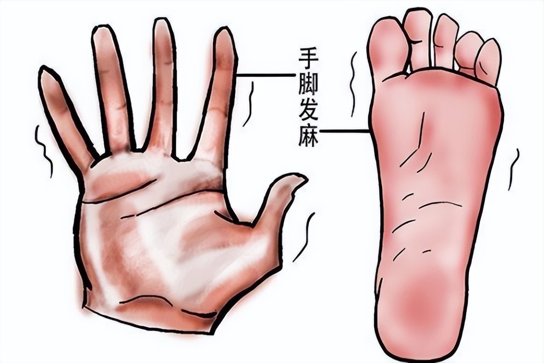 乳腺癌化疗手和脚麻怎么回事,乳腺癌化疗5年脚麻