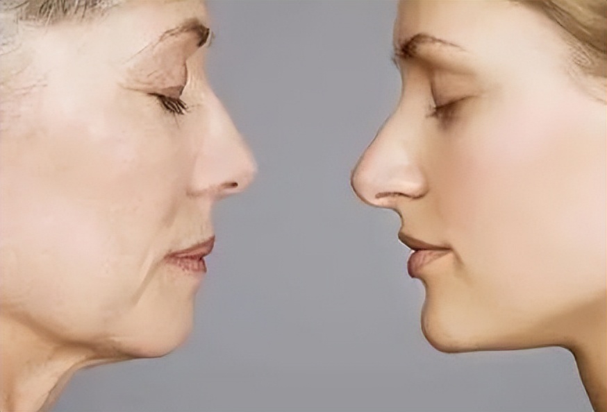 护肤小知识脸部缺水,脸很糙从哪里开始护肤