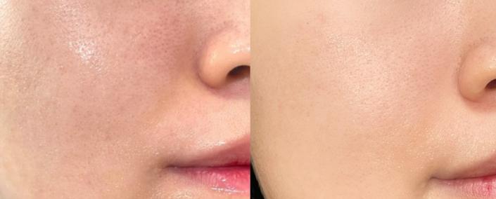 nutrakos胶原蛋白,nutraorganics胶原蛋白肽