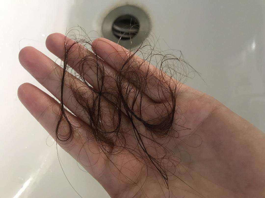 不同发质适合什么洗发水呢,发质稀薄脱发用什么洗发水