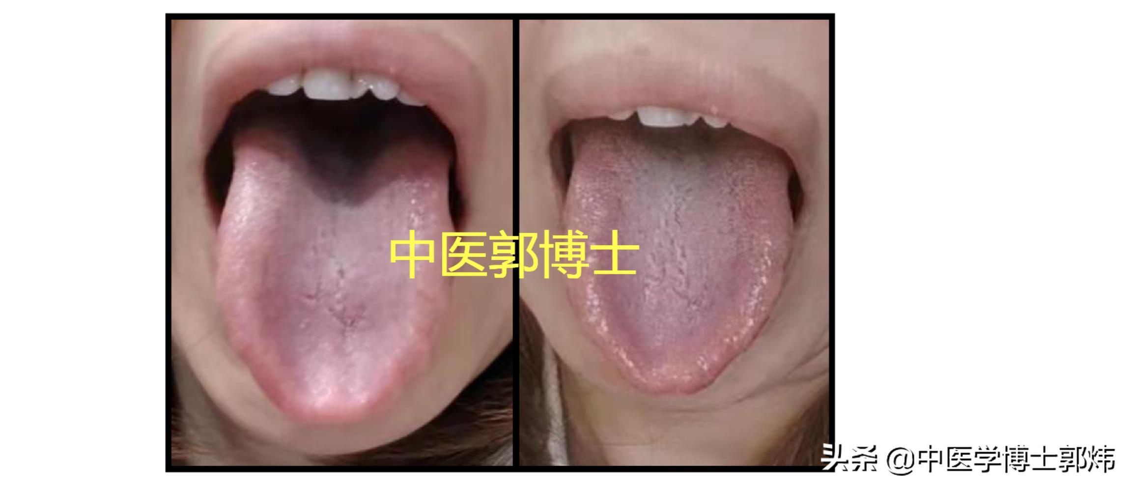 月经量少失眠辨证,失眠多梦入睡困难分享一剂经方