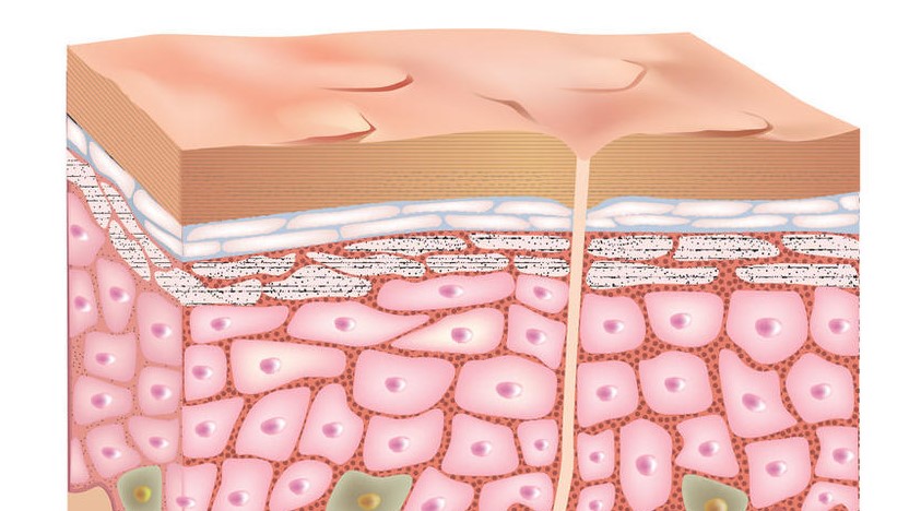 头发是卷的为啥眉毛是直的,头发自然卷毛怎么自己长直发