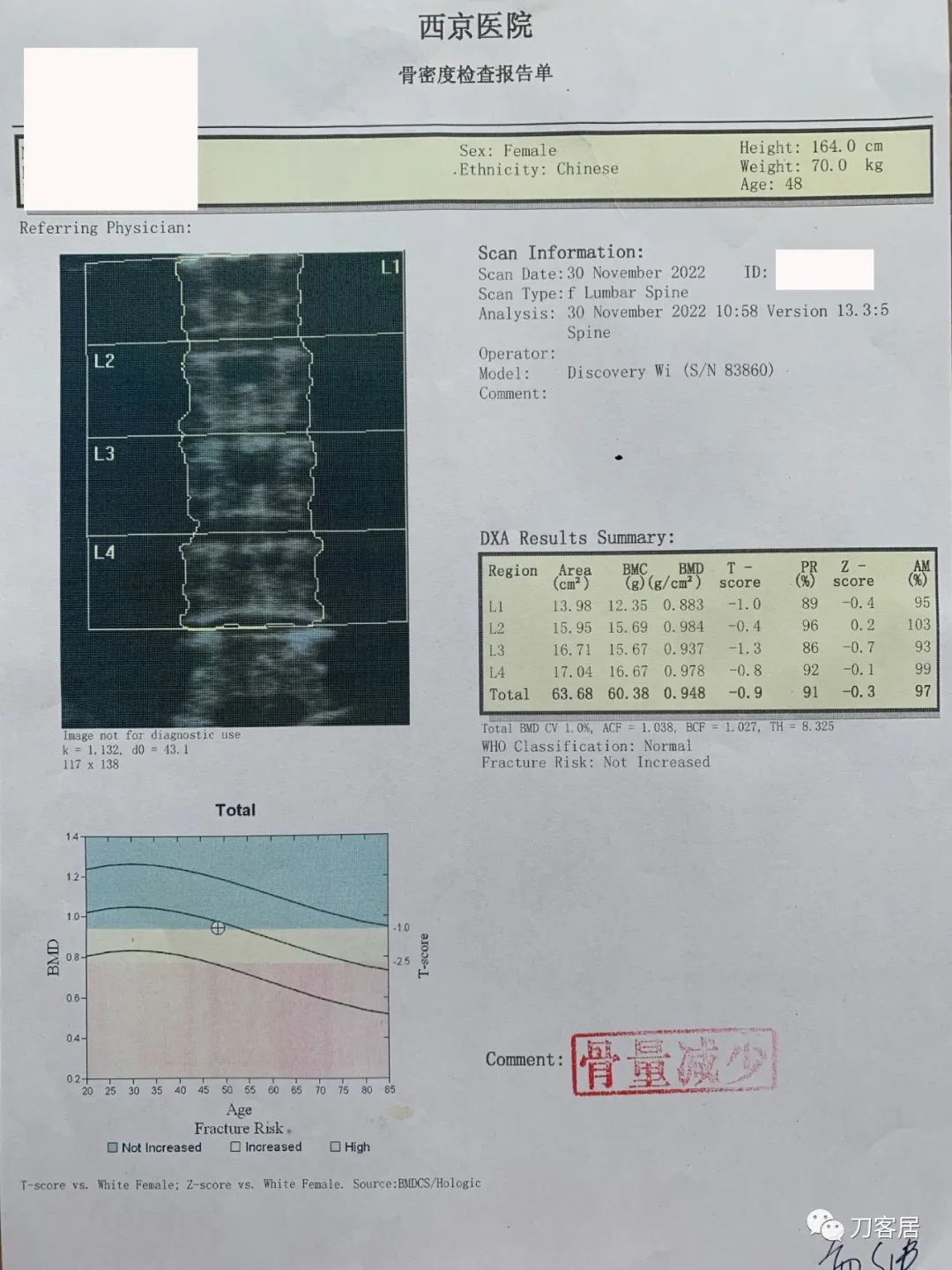 感染新冠左侧腰腹抽痛,腿酸疼是新型冠状病毒怎么治疗