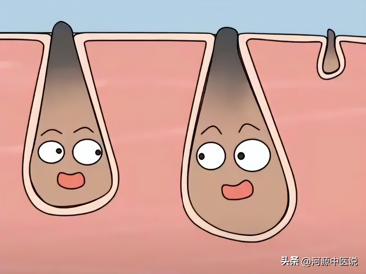 黑头应该怎么去99%的人不知道,黑头处理的最佳方法医生推荐