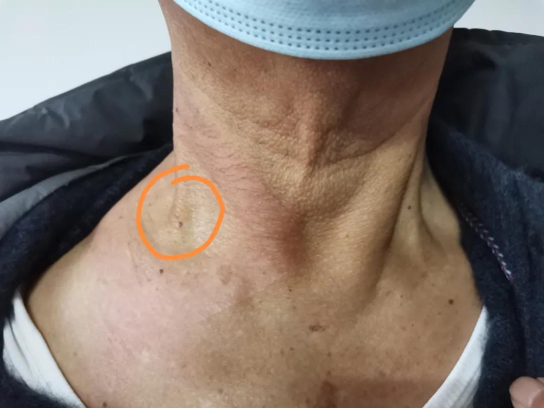 「赞」我院普外科开展新技术献礼四川大学华西春熙医院揭牌仪式