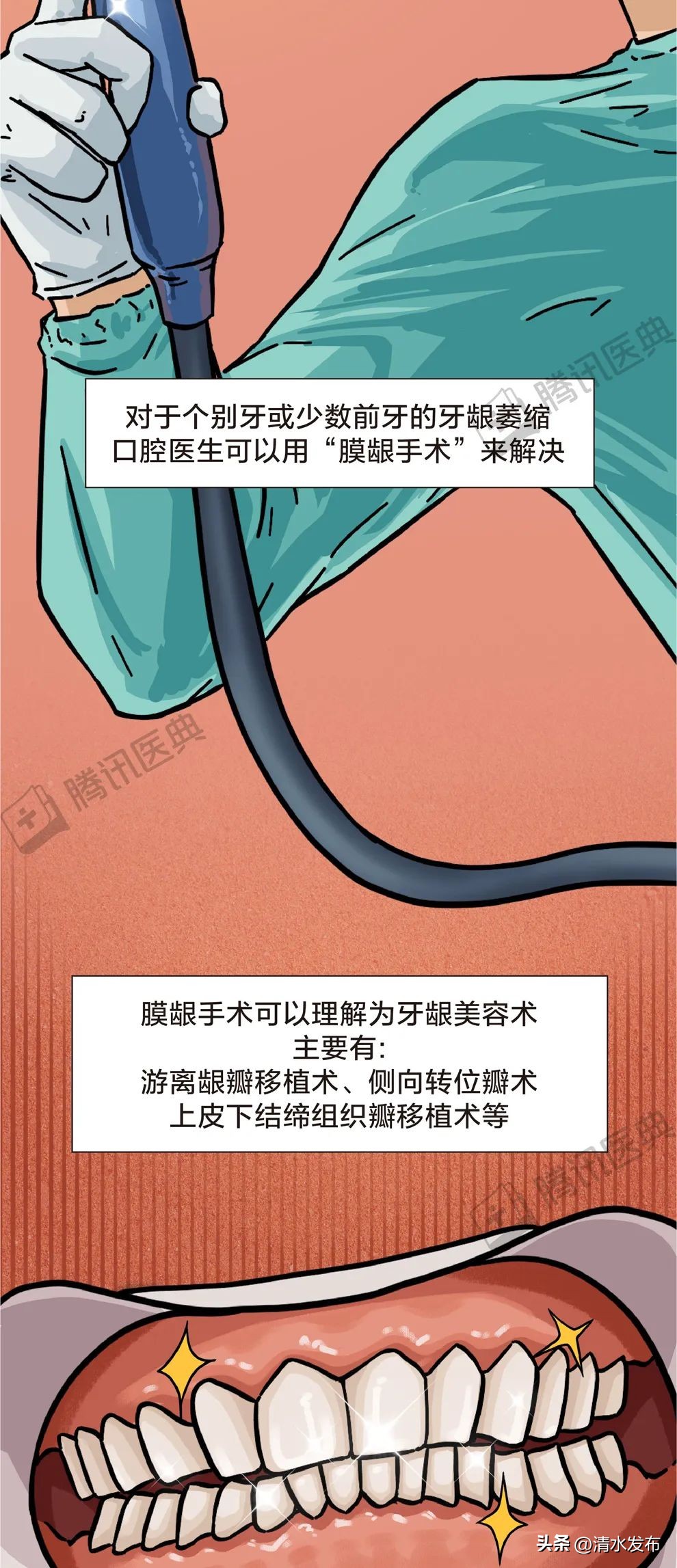 两边大牙一吃肉就塞牙如何修复,14岁学生吃肉老是塞牙需要矫正吗