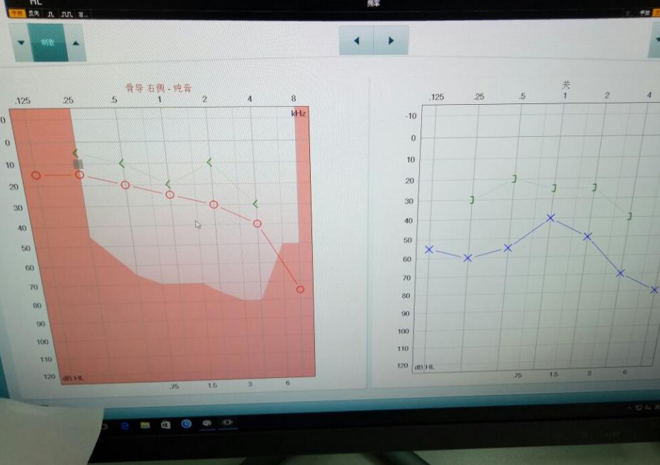 耳朵总是痒痒是身体哪里出问题了,耳朵经常痒得很是什么原因
