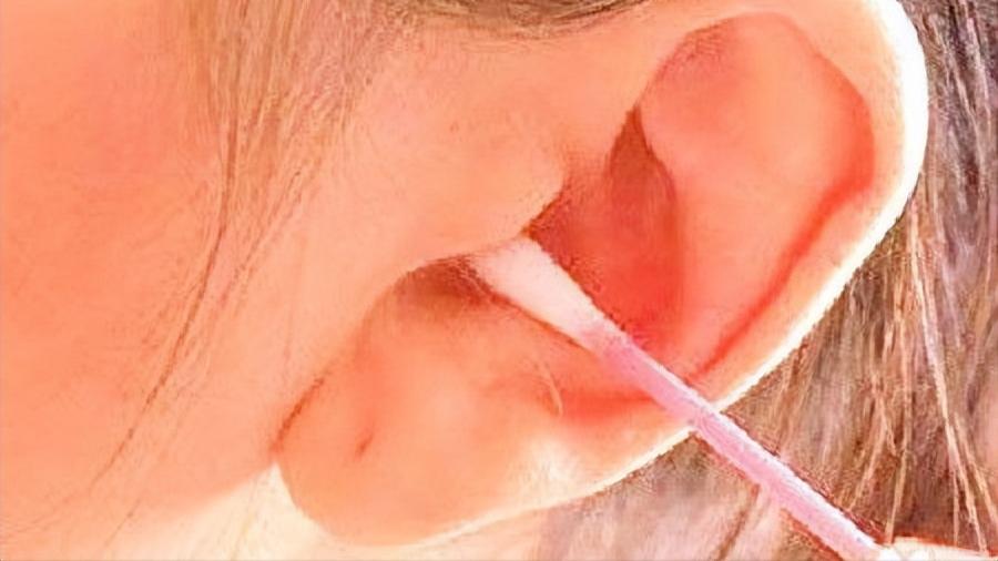 面神经麻痹后遗症的最佳治疗方法,面神经麻痹面部有麻木感觉吗