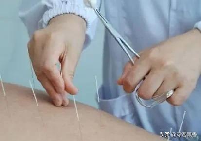 不幸的车祸医生的疏忽疼痛一直相随了我二十余年