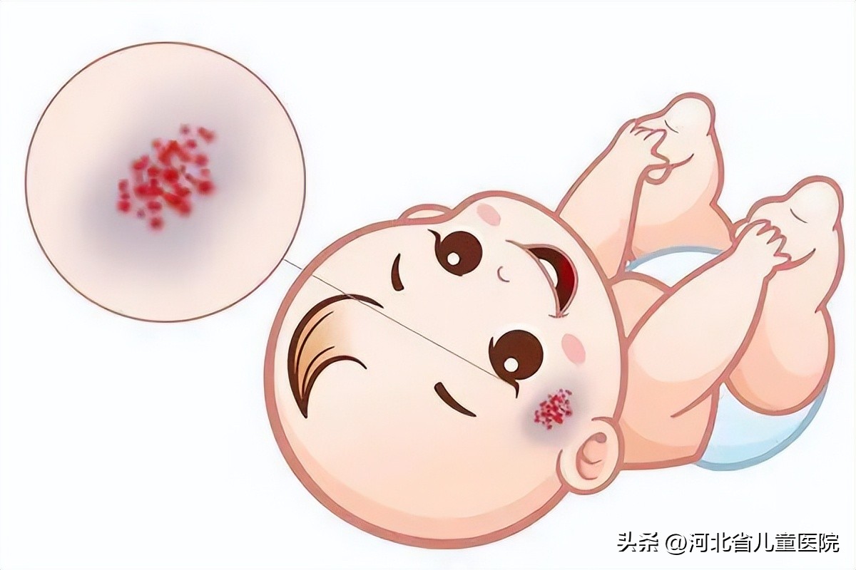 孩子脸上长了红色的点点,孩子脸上长红点点是怎么回事